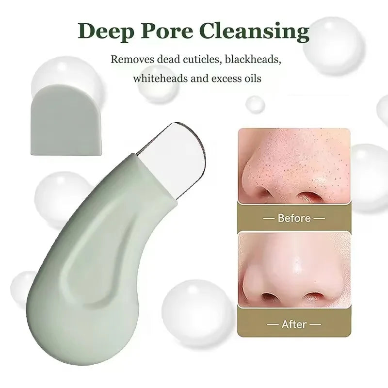 Blackhead & Whitehead Removal Tool – Facial Pore Cleaner